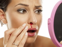 Menstrual hematemesis